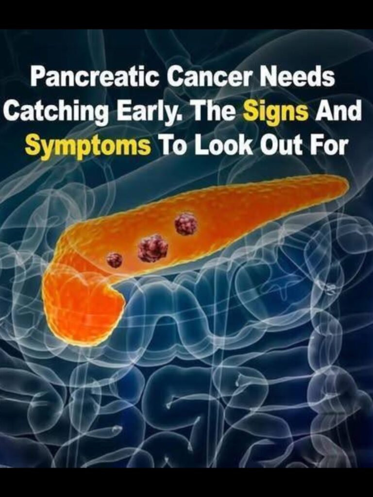 10 Signs of Pancreatic Cancer You Shouldn’t Ignore (And When to See a ...